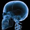 X-Ray Scanner